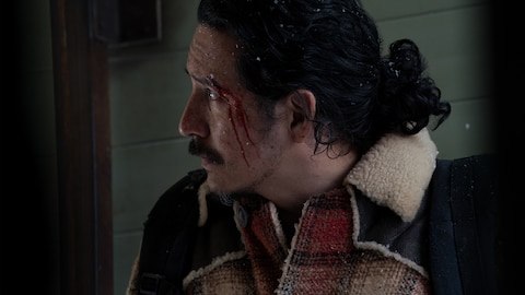 Close-up of Tommy with a cut above his left eyebrow. A trail of blood has run down his cheek. He has snow in his hair. He looks at something out of frame.