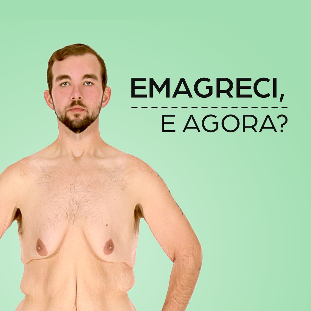 Emagreci, e Agora?