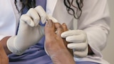 Hammertoes Happen
