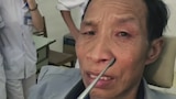 Mystery of the Face Parasite