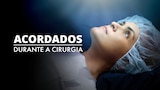 Acordados Durante a Cirurgia