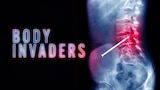 Body Invaders