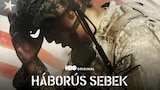 Háborús sebek