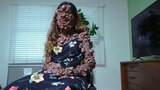 The Woman Covered in Thousands of Tumors