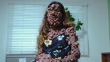 The Woman Covered in Thousands of Tumors