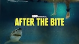 After the Bite