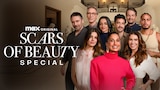 Scars of Beauty Special
