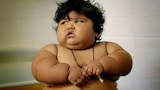 World's Fattest Baby