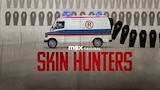 Skin Hunters