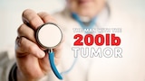 The Man with the 200lb Tumor