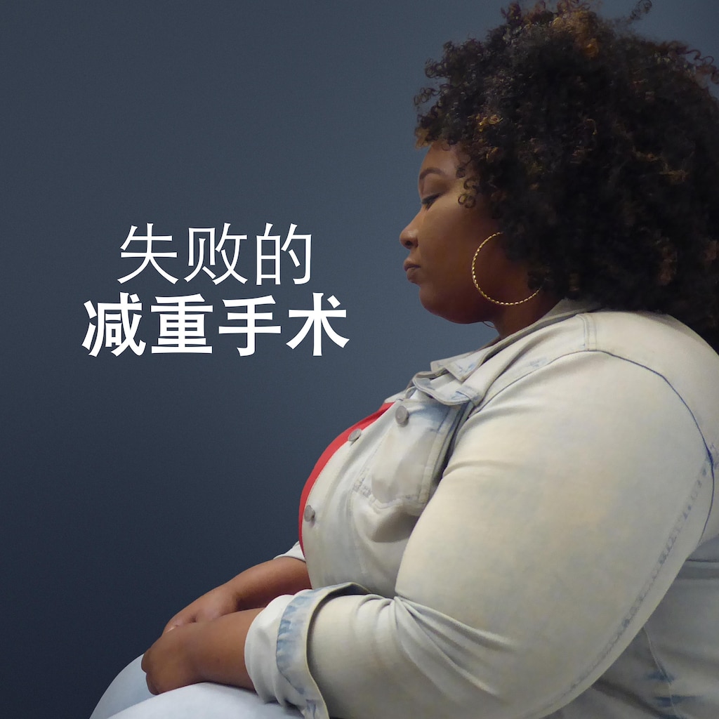 失败的减重手术