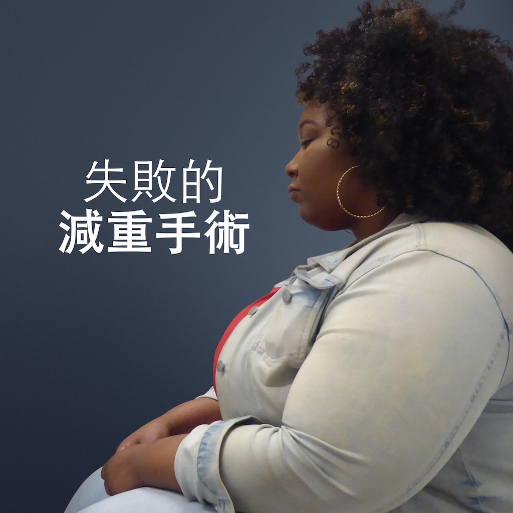 失敗的減重手術