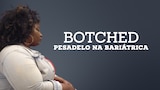 Botched: Pesadelo na Bariátrica