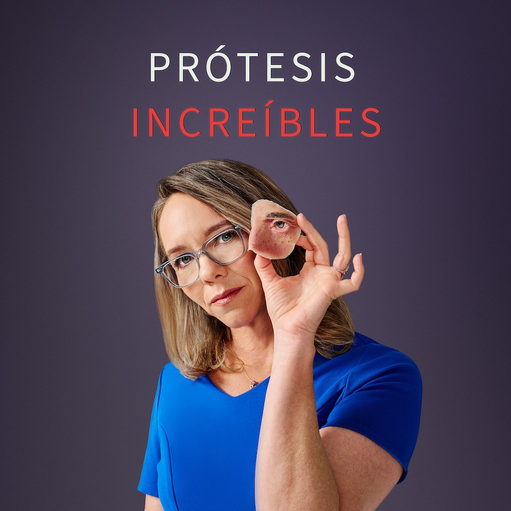 Prótesis increíbles