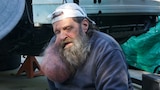 The Man With the Talking Neck Tumor